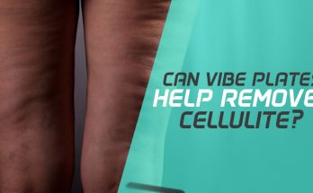 Can Vibration Machines Remove Cellulite?